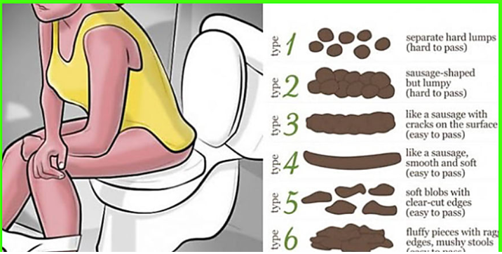 Believe It Or Not, Poop Tells About Your Health