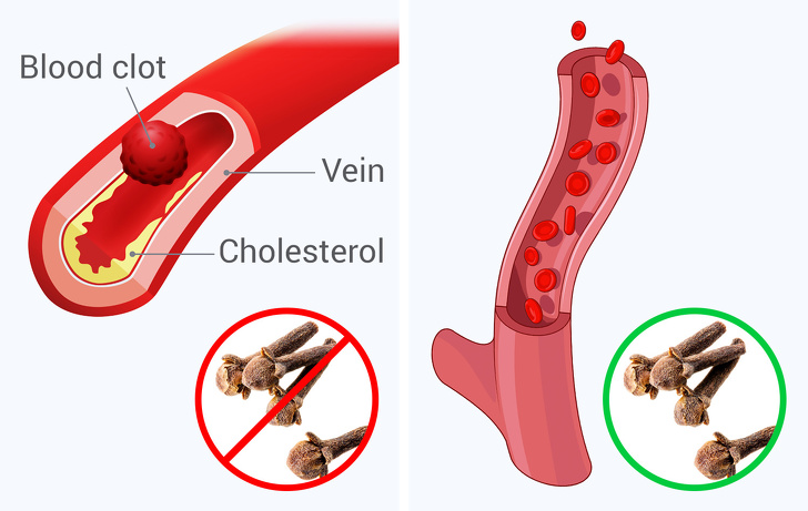 This Will Happens to Your Body If You Start Eating 2 Cloves a Day