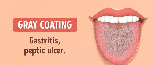 13 Things Your Tongue Say About Your Health