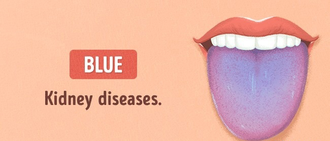 13 Things Your Tongue Say About Your Health