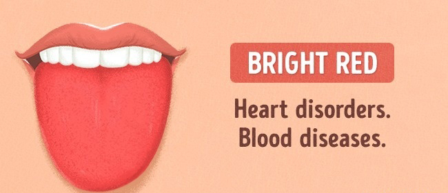 13 Things Your Tongue Say About Your Health