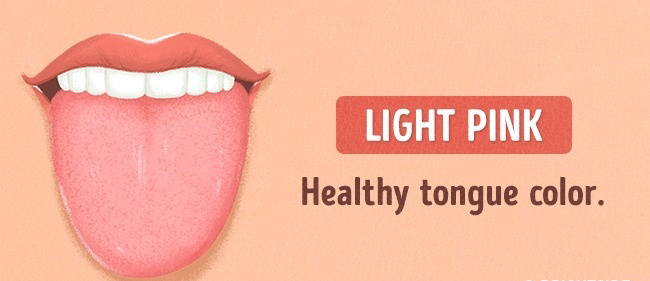 13 Things Your Tongue Say About Your Health