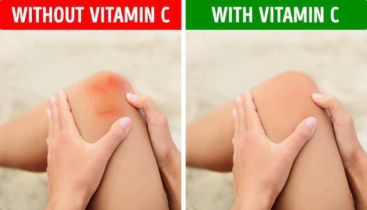 10 Early Symptoms Your Body Is Running Out of Vitamin C