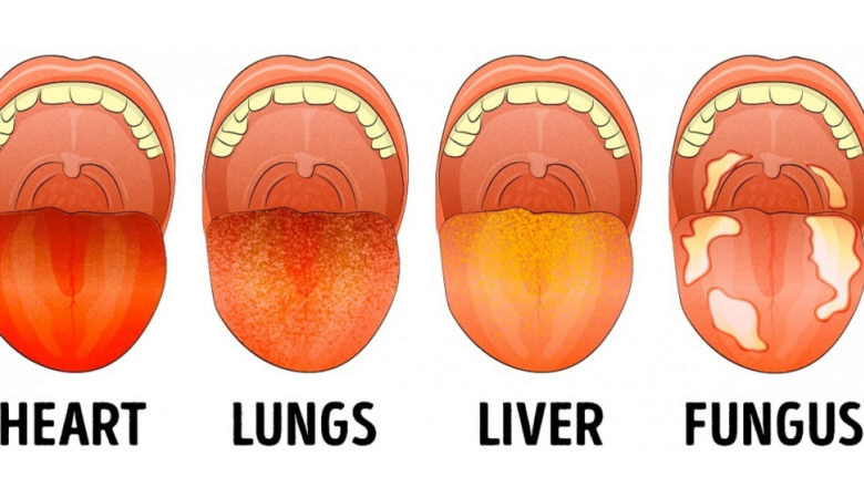 13 Things Your Tongue Say About Your Health