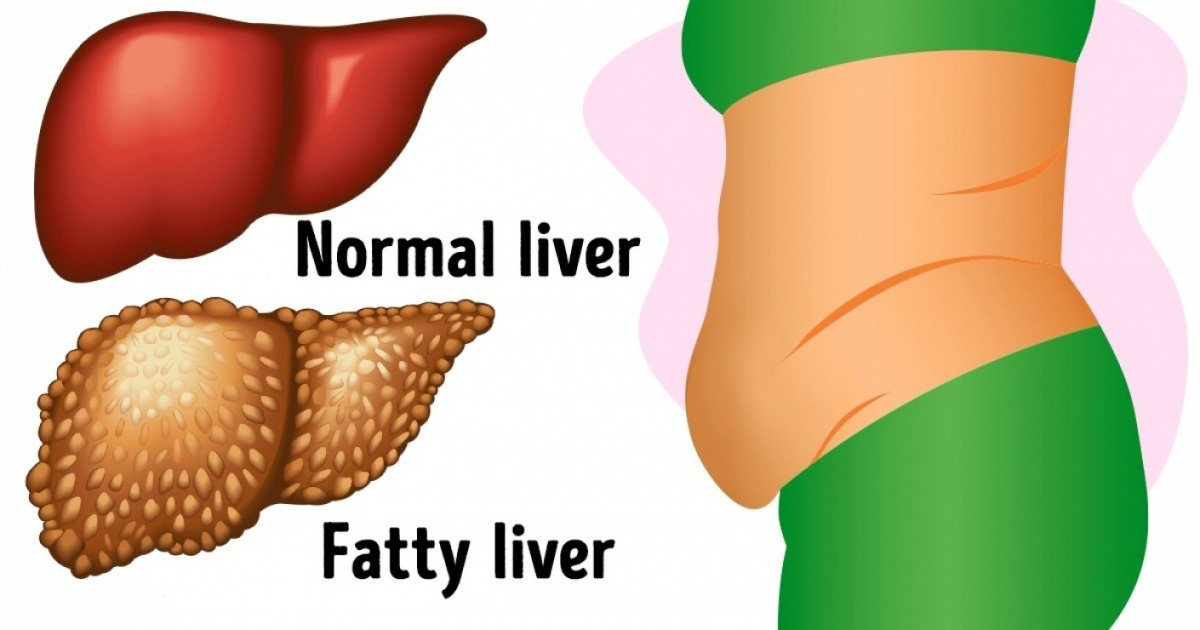 6 Warning Symptoms That Show Your Liver Is Full of Toxins