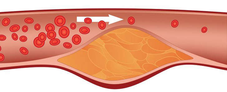 This Will Happen to Your Body If You Eat Papaya Once a Week