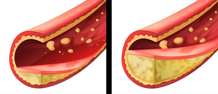 9 Things That Will Happen To Your Body When You Gain Weight