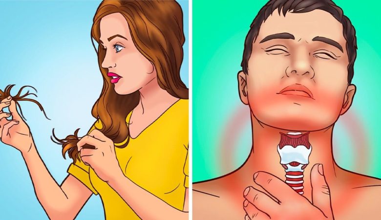8 Symptoms That Your Body Is Begging for More Iodine