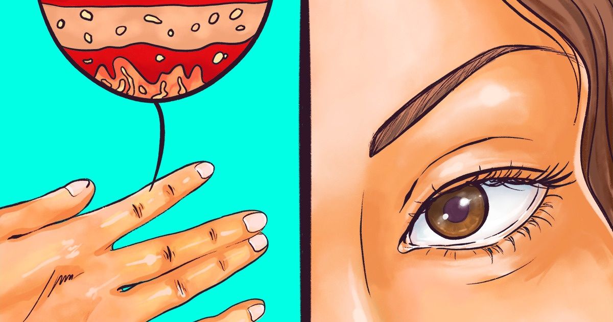 7 Signs That Explain Your Thyroid Doesn’t Work Properly