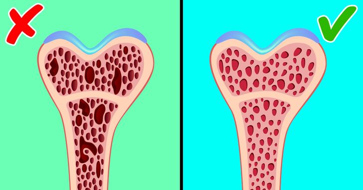 7 Tips to Help Keep Your Bones Strong And Healthy