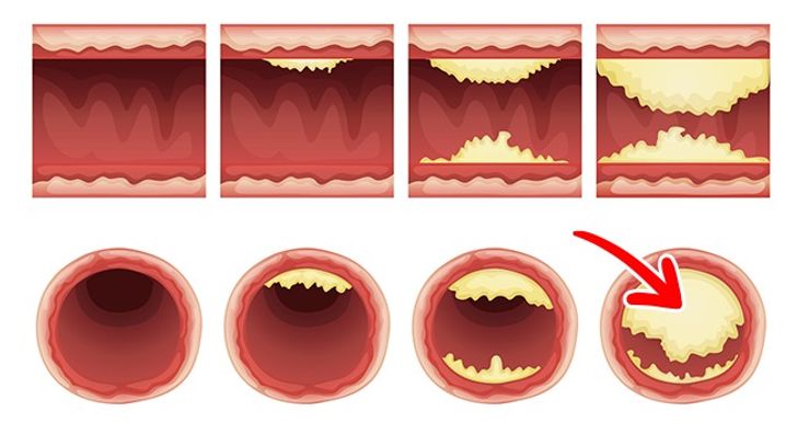 7 Things That Can Happen to Your Body If You Start Eating 2 Eggs a Day