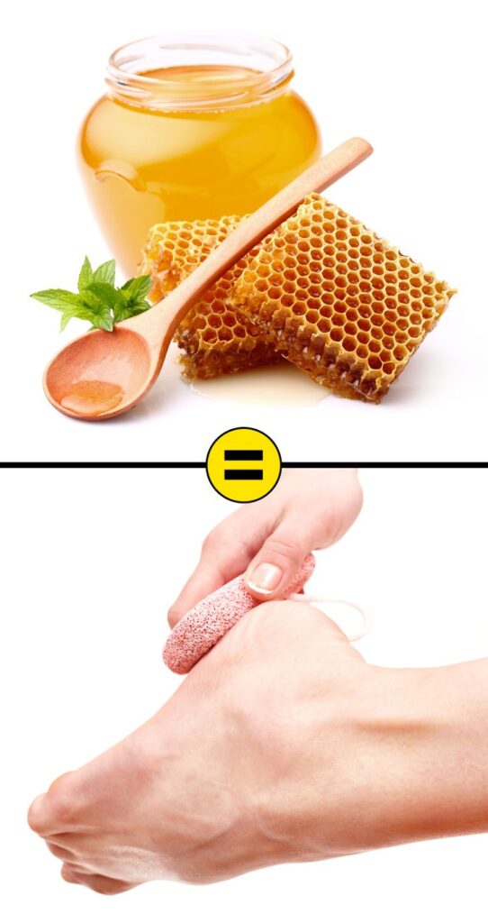 10 Effective Home Remedies to Remove Cracked Heels and Get Beautiful Feet