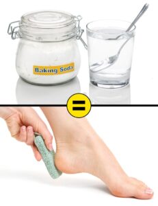 10 Effective Home Remedies To Remove Cracked Heels And Get Beautiful ...