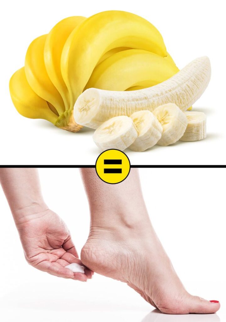 10 Effective Home Remedies to Remove Cracked Heels and Get Beautiful Feet