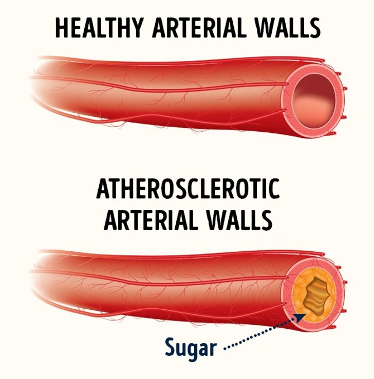 4 Dangerous Properties of Sugar We Had No Idea About