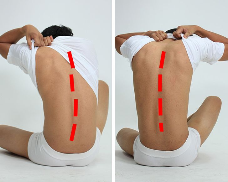10 Ways to Get Rid of Back Pain for Good