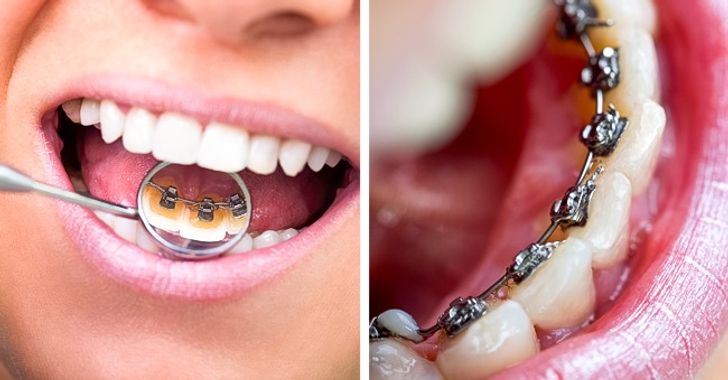 6 Major Mistakes We Make When Taking Care of Our Teeth