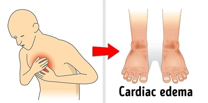 This Will Happen to Your Body If You Ignore These Symptoms