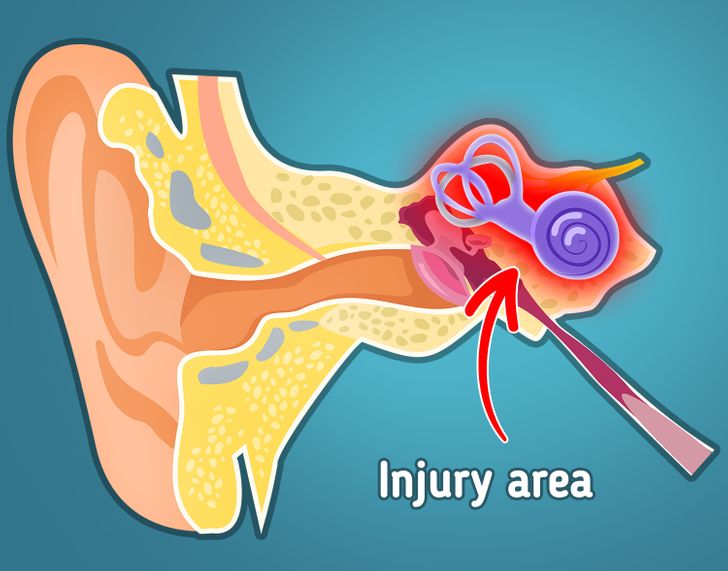 Why We Hear a Ringing in Our Ears and What May Be Causing It