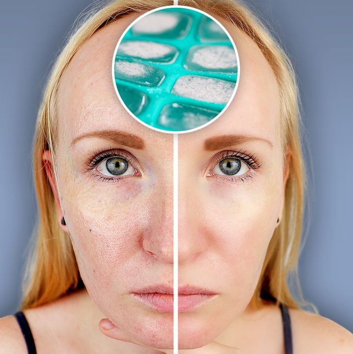 What Can Happen to Your Skin When You Rub Ice on the Face Every Day