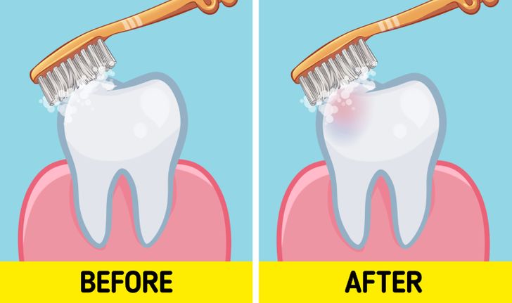 Should You Brush Your Teeth Before or After Breakfast?