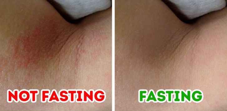What can happen to your skin if you fast?