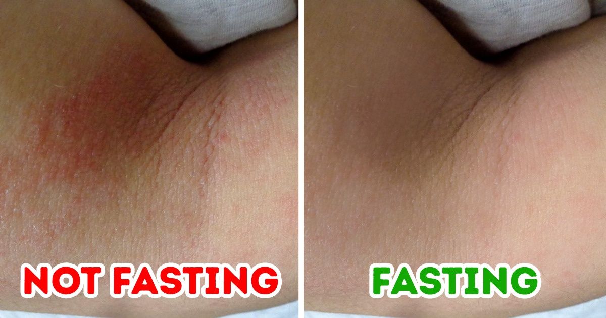 What Could Happen to Your Skin if You Fast
