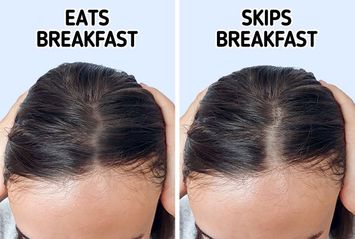 6 Daily Habits That Are Causing Your Hair to Thin