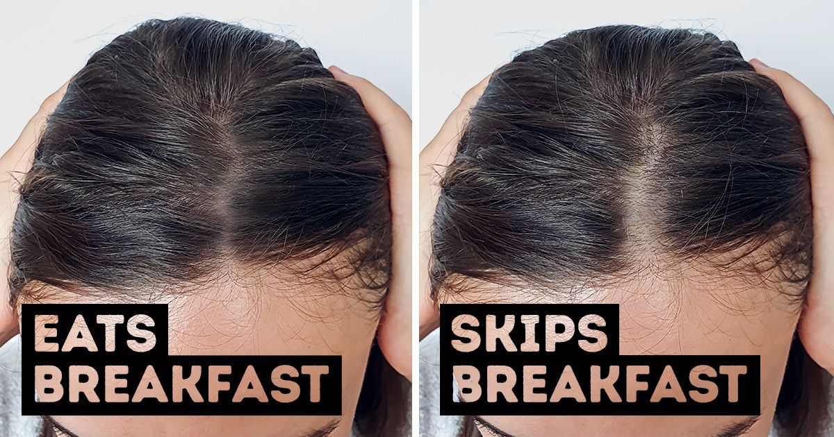 6 Daily Habits That Are Causing Your Hair to Thin