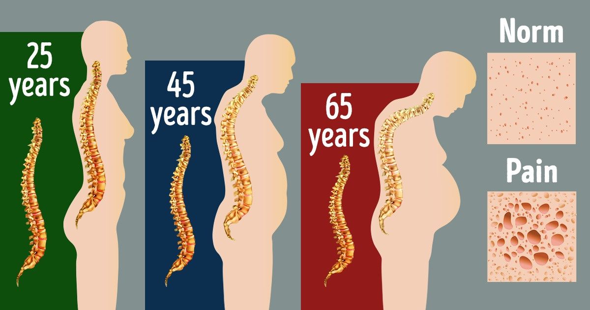 6 Everyday Habits That Destroy Your Spine
