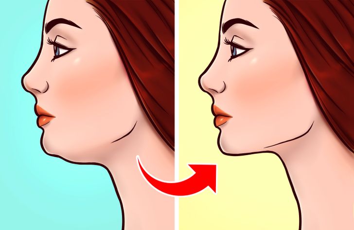 How Tongue Posture Can Change Your Face