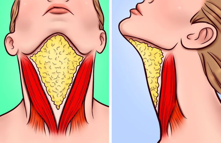 How Tongue Posture Can Change Your Face