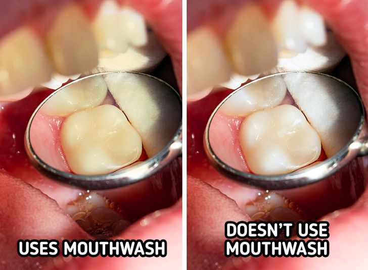 6 Daily Habits That Are Staining Your Teeth