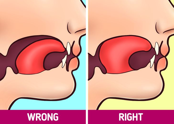 How Tongue Posture Can Change Your Face