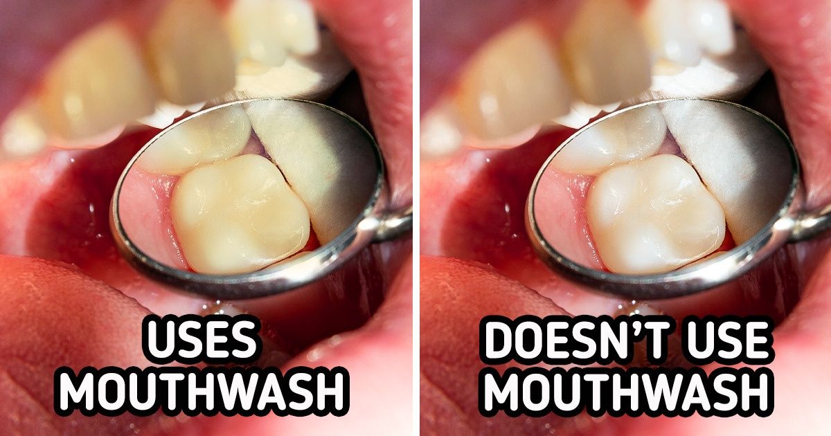 6 Daily Habits That Are Staining Your Teeth