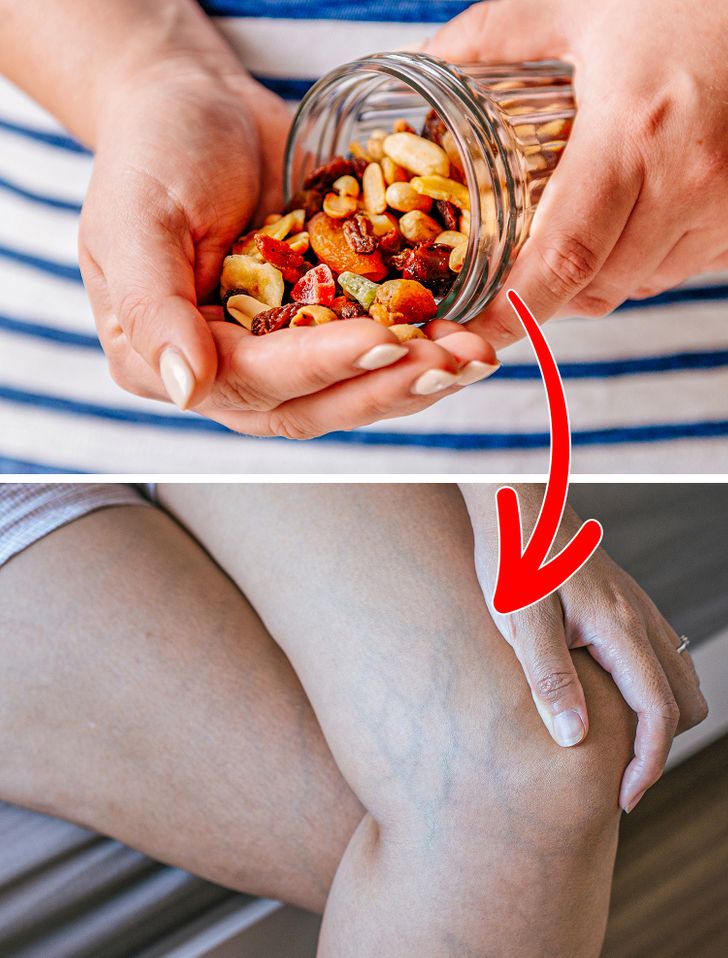 6 Daily Habits That May Damage Your Veins