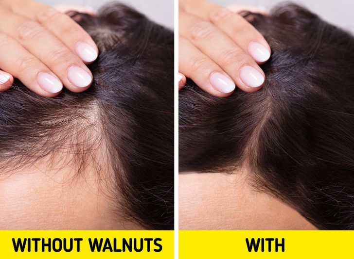 What Can Happen to Your Skin If You Eat Walnuts Every Day