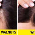 What Can Happen to Your Skin If You Eat Walnuts Every Day