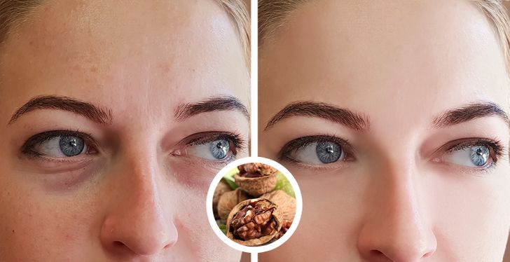 What Can Happen to Your Skin If You Eat Walnuts Every Day