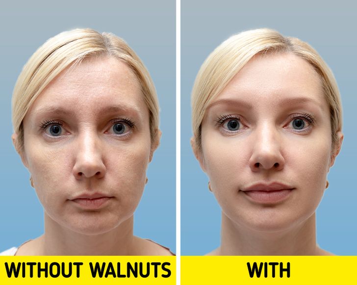 What Can Happen to Your Skin If You Eat Walnuts Every Day