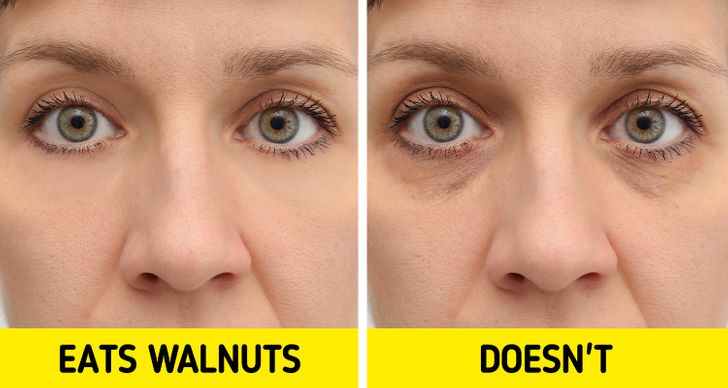 What Can Happen to Your Skin If You Eat Walnuts Every Day