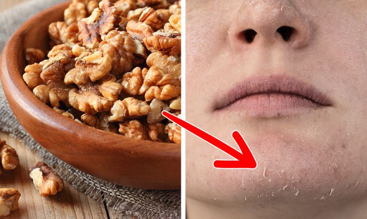 What Can Happen to Your Skin If You Eat Walnuts Every Day