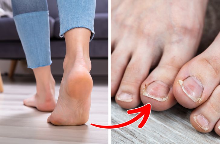 Why You Shouldn’t Walk Around Barefoot, Even at Home