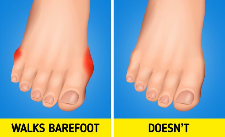 Why You Shouldn’t Walk Around Barefoot, Even at Home