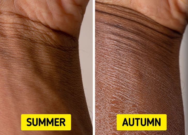 6 Things That Can Happen to Your Body in Autumn and Why