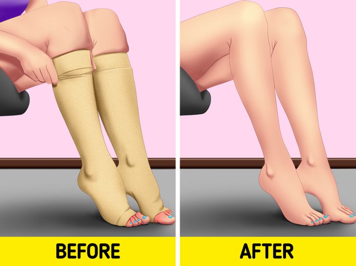 6 Tips for Swollen Legs Your Body Will Thank You For