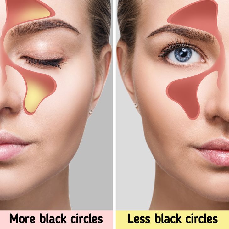 6 Tips to Reduce Black Circles and Tiredness Under the Eyes
