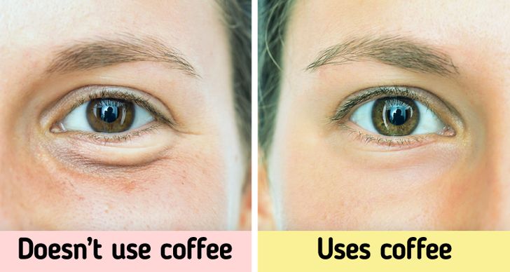 6 Tips to Reduce Black Circles and Tiredness Under the Eyes