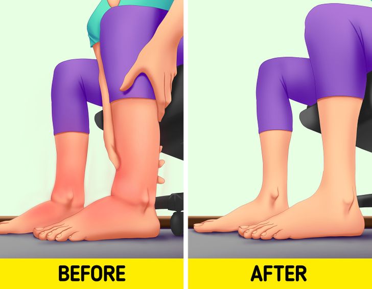 6 Tips for Swollen Legs Your Body Will Thank You For