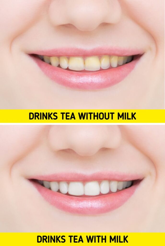 7 Tips to Make Your Teeth White and Healthy
